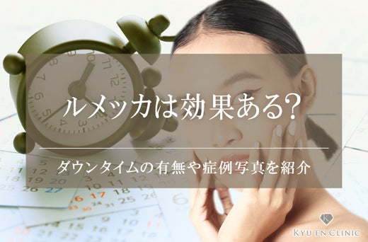 ルメッカの効果は?ダウンタイムや施術後の経過・料金について徹底解説