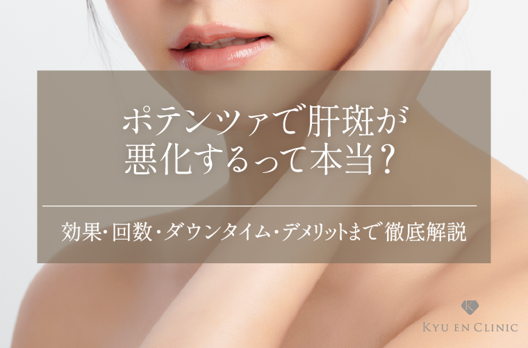 ポテンツァで肝斑が悪化するって本当？効果・回数・ダウンタイム・デメリットまで徹底解説