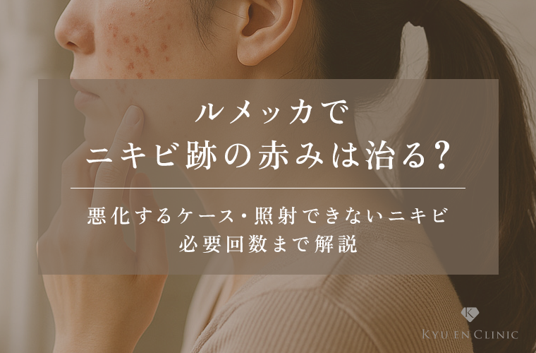 ルメッカでニキビ跡の赤みは治る？悪化リスクや照射NG例を医師が解説