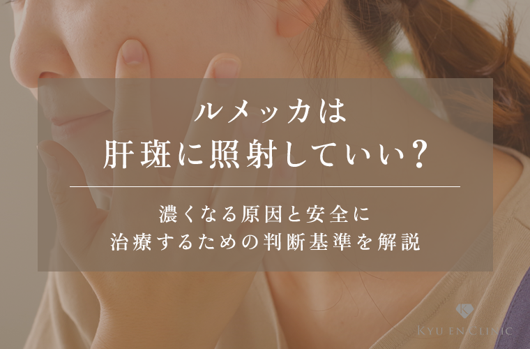 ルメッカは肝斑に照射していい？悪化する原因とケースを詳しく解説