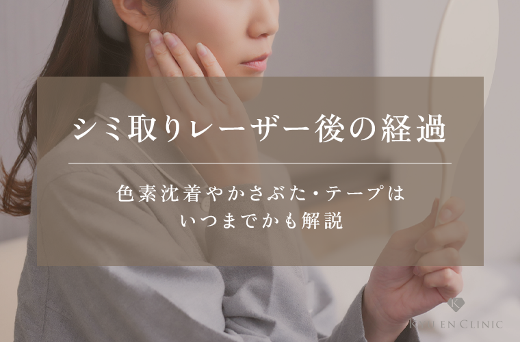 シミ取りレーザー後の経過｜色素沈着やかさぶた・テープはいつまで必要か解説